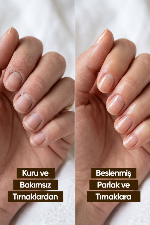 Arifoğlu Tırnak Bakım Yağı 5 ml - Arifoğlu Online